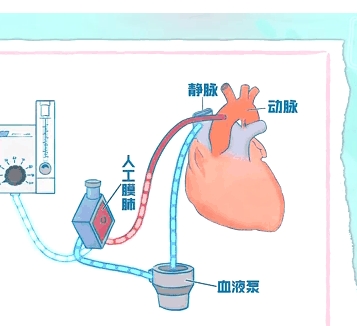 動態心肺音數據存儲傳輸軟件ld-hls理得